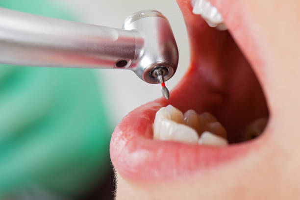 Best Weekend Emergency Dental Services in North Fair Oaks, CA